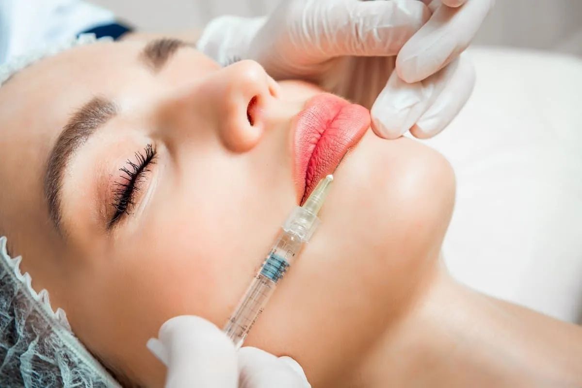 DERMAL FILLERS Tampa