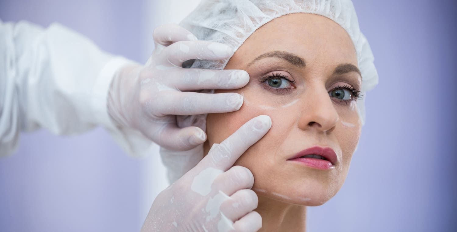 what affects dermal filler longevity