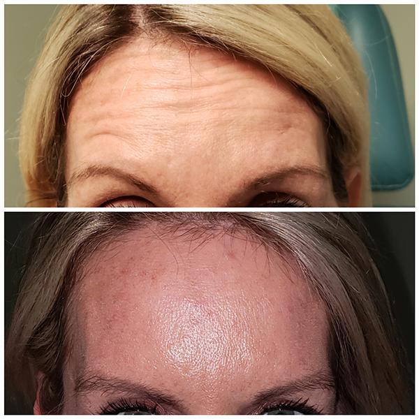 Gallery Lancaster, OH Medical Spa NP