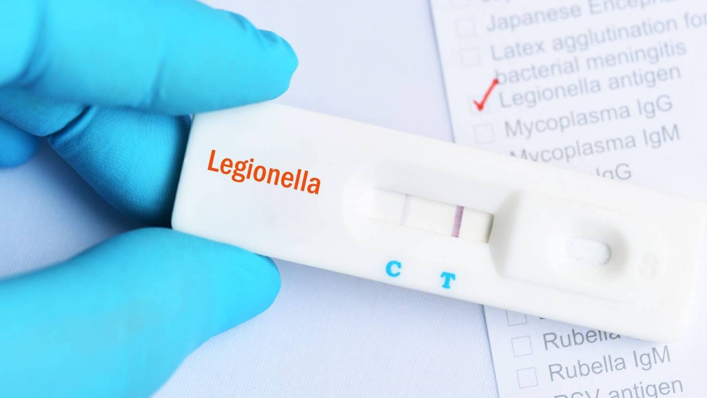 a person is holding a test that says legionella on it