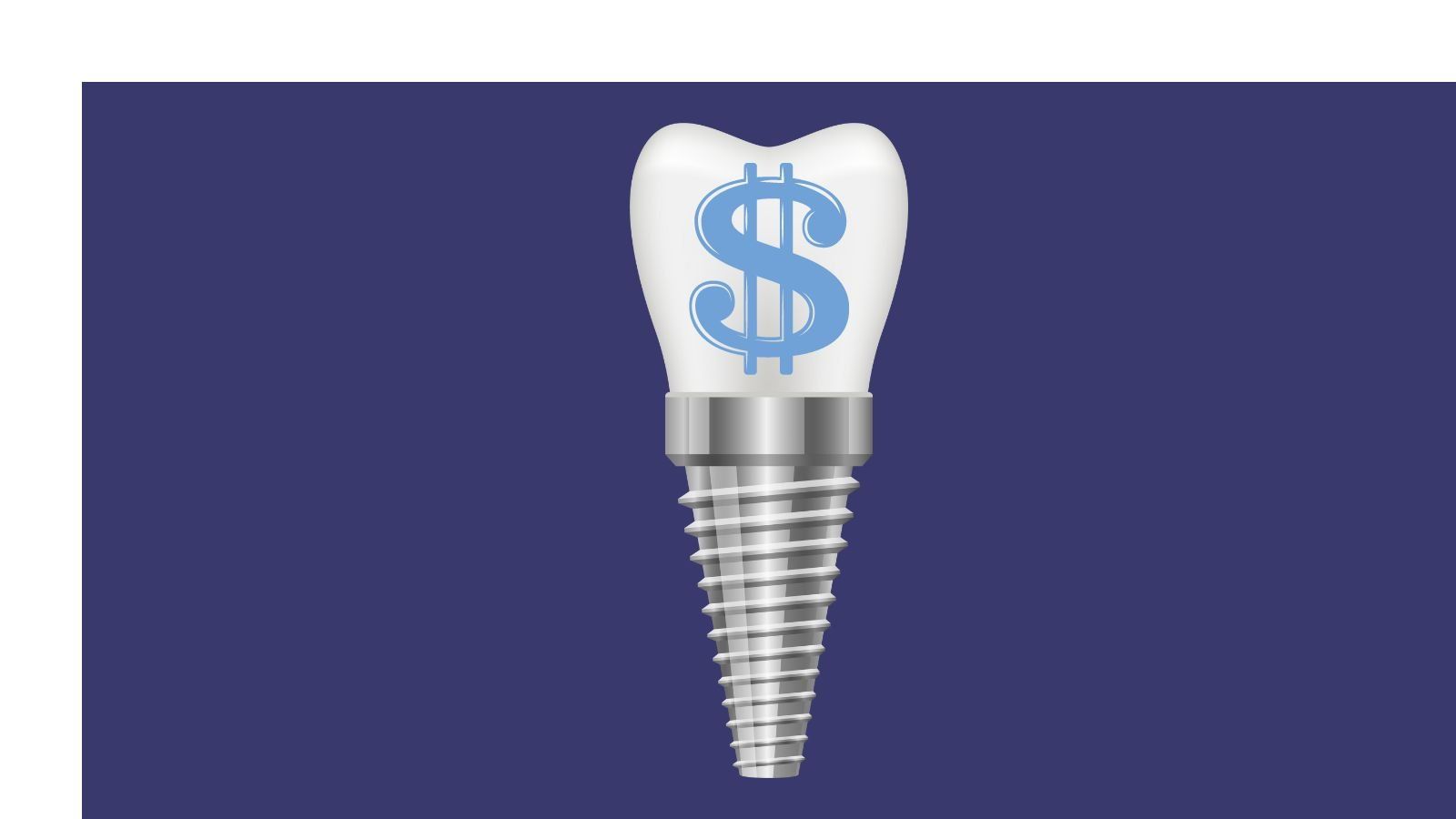 Does My Insurance Plan Cover Dental Implants?