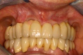 Un primo piano dei denti e della bocca di una persona