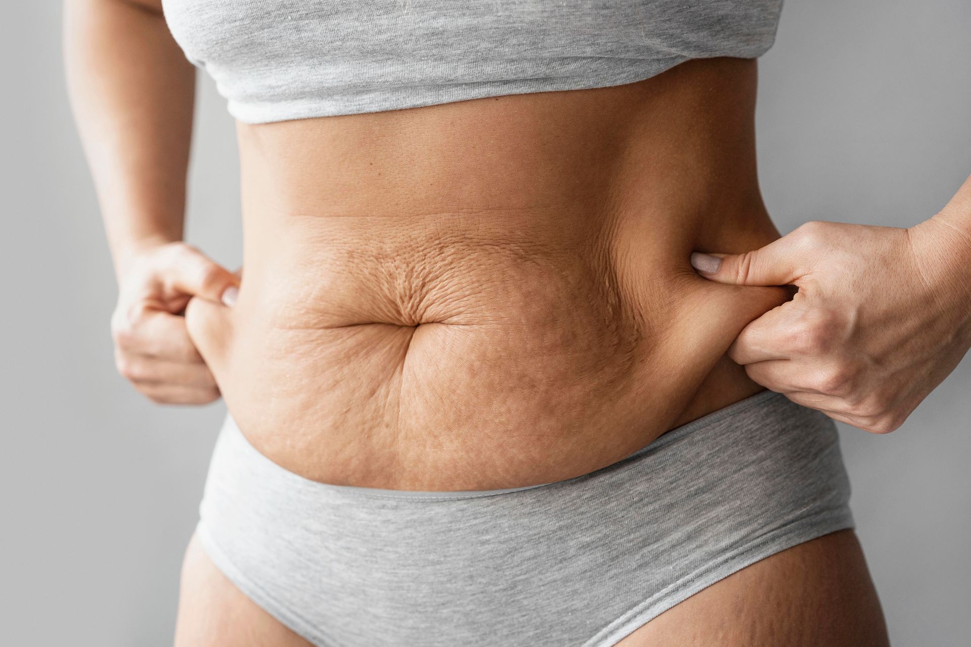 Abdominoplastia para barriga caída em São Paulo