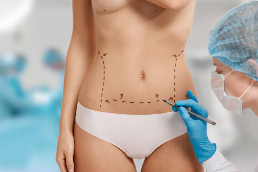 Cirurgião Plástico para Lipoaspiração em São Paulo: Como Escolher o Melhor Profissional