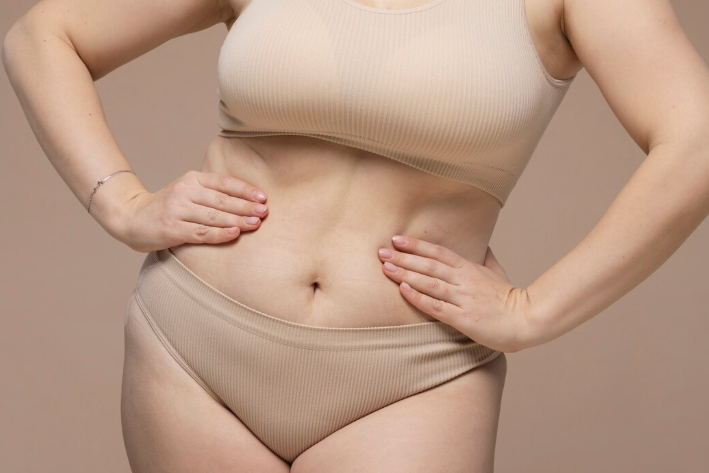 Posso fazer a abdominoplastia depois de quanto tempo pós-parto