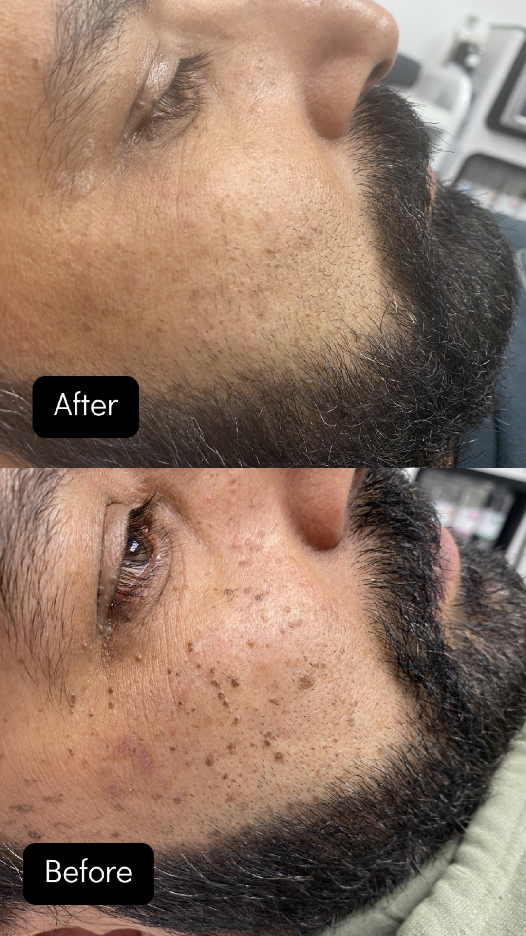 Side-by-side comparison of a person's face. The 