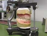 Denture being made — Dentures in Yakima, WA