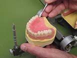 New Denture being Made — Dentures in Yakima, WA