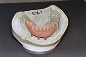Denture in Mold — Dentures in Yakima, WA