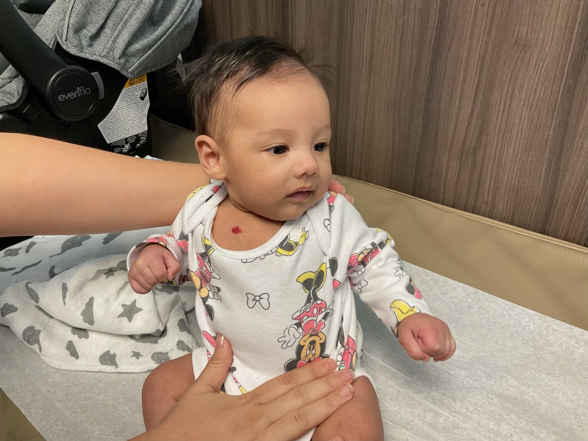 Caring For Your Infant With Hemangioma