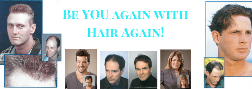 hair restoration at Hair Again LLC
