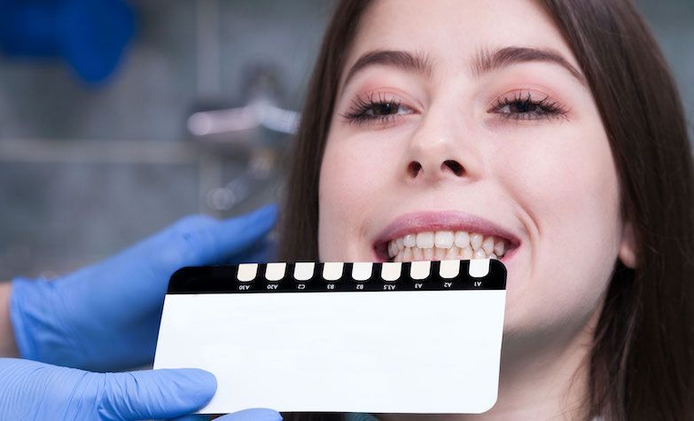 Moters dantų emalės spalvų testeris