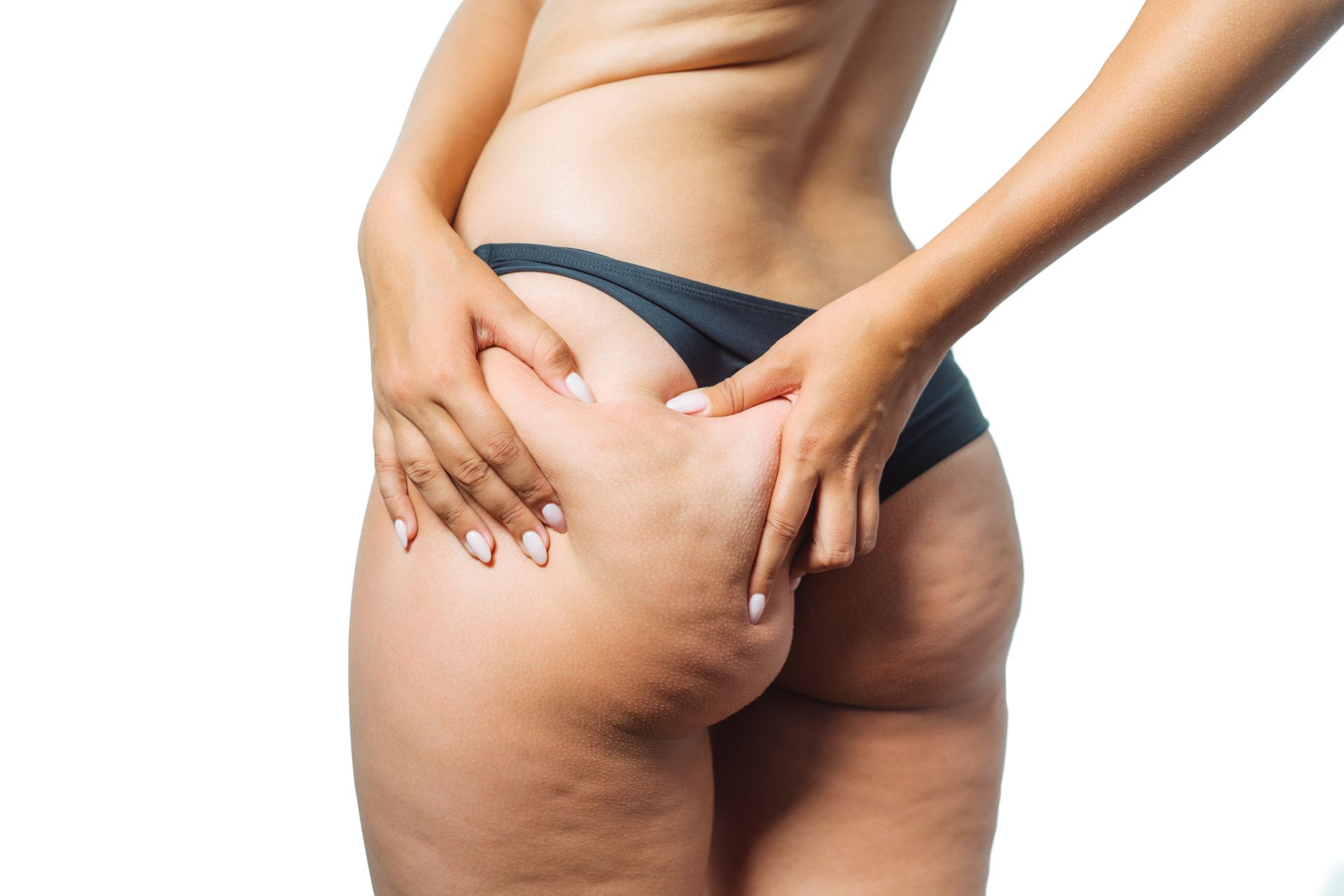girl shows cellulite