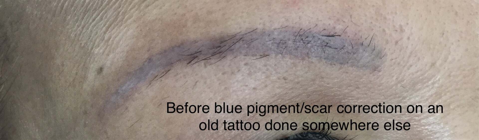 Before Scar Correction On Old Tattoo — Cosmetic Tattooing in Bundaberg, QLD