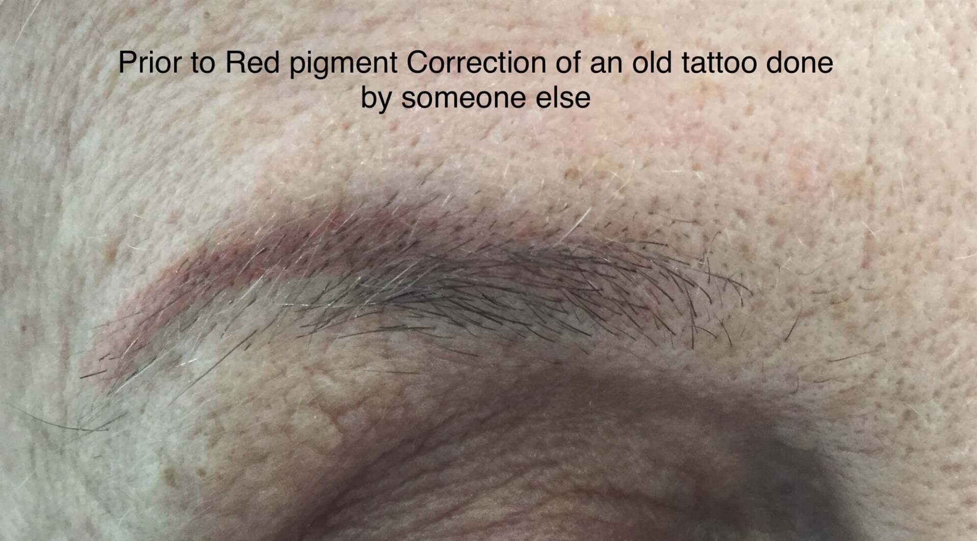 Before Red Pigment Correction On Old Tattoo — Cosmetic Tattooing in Bundaberg, QLD