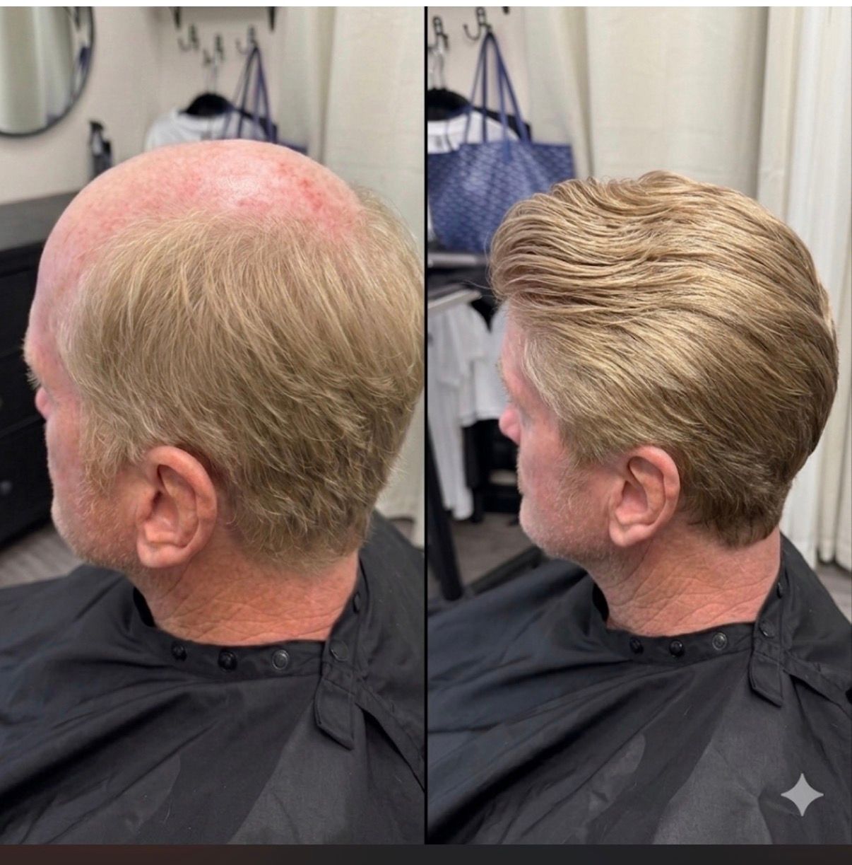 Man with thinning hair looks distressed at his reflection in a red hand mirror.