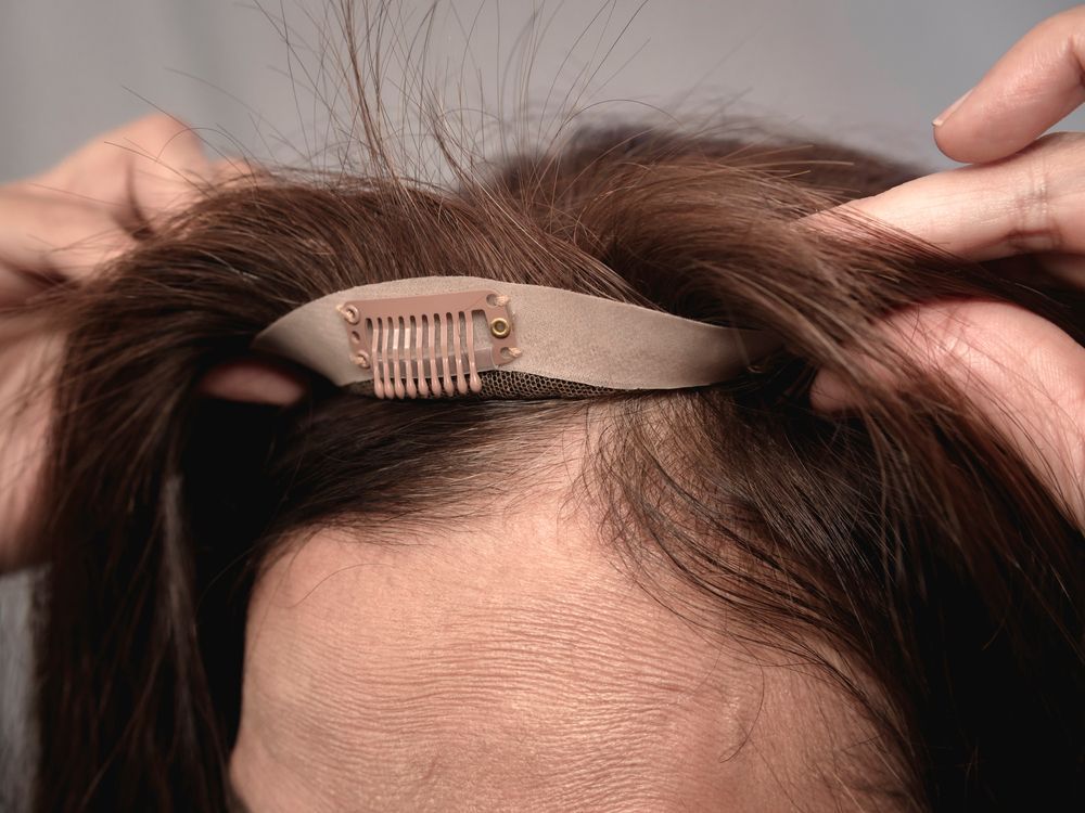 Hands attaching a hair topper with a clip to a person's head, adding volume to brown hair.