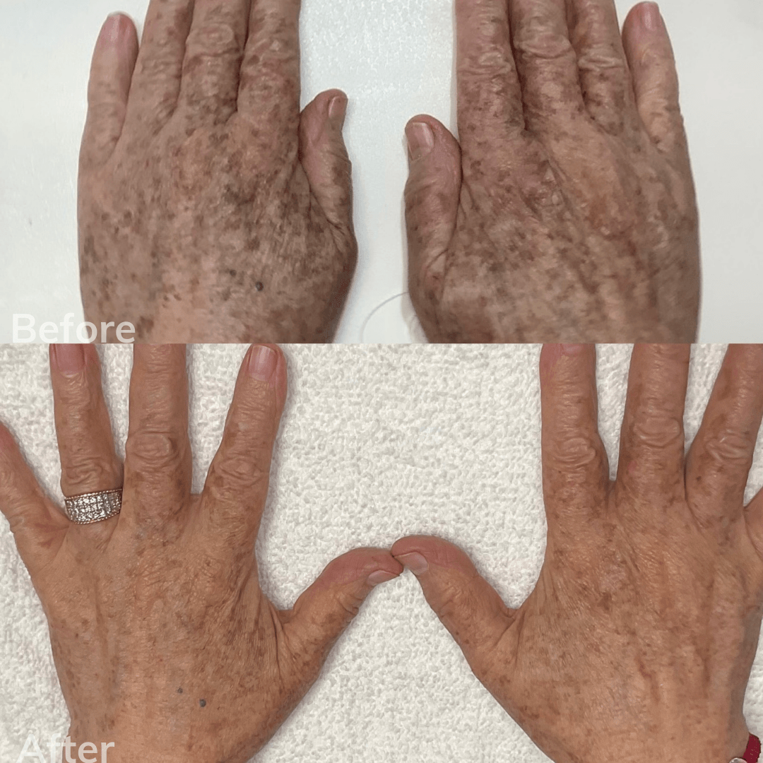 Wrinkle Treatment Carlsbad