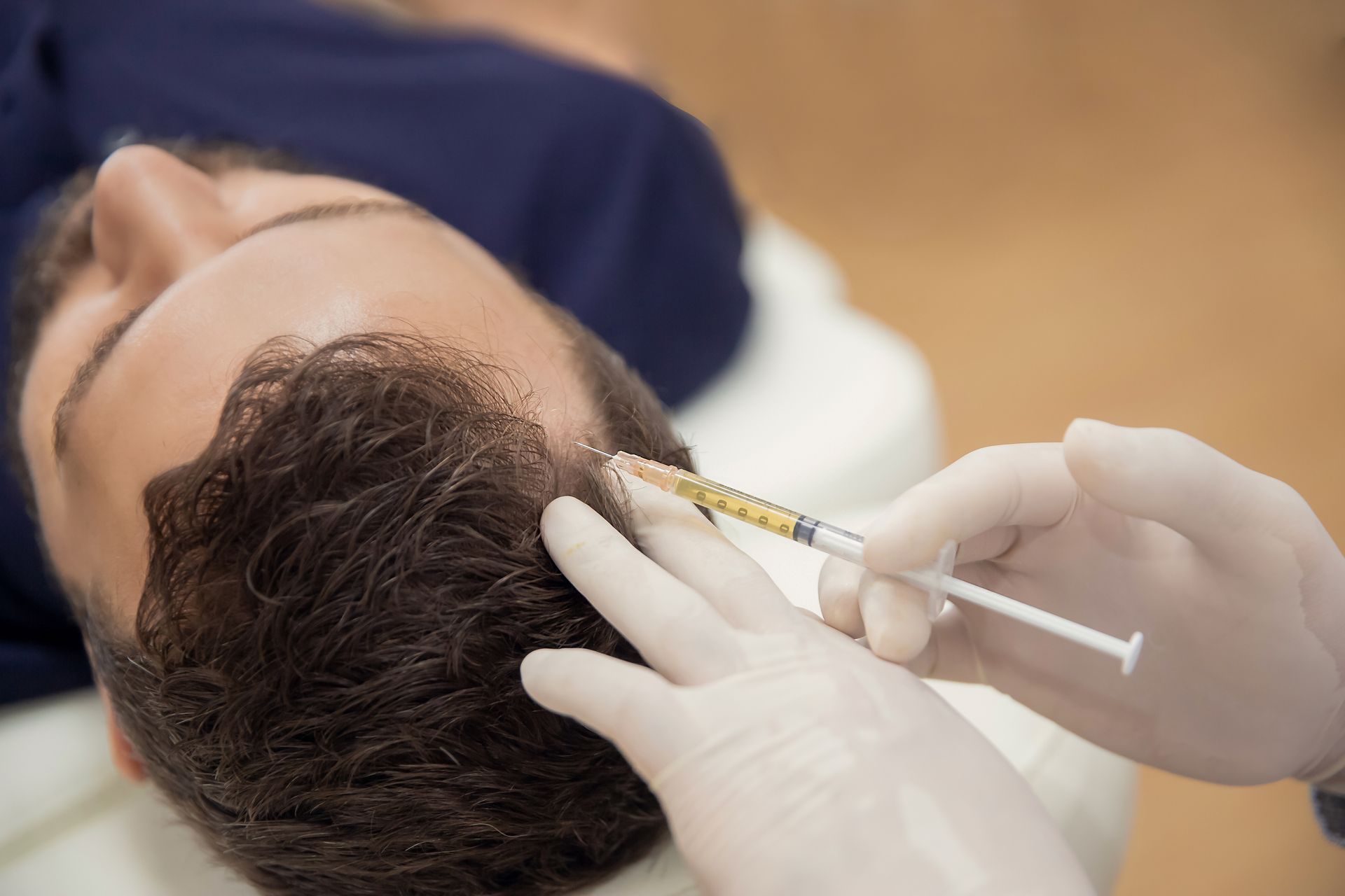 Gloved hands inject a man's scalp with a syringe during a hair treatment procedure