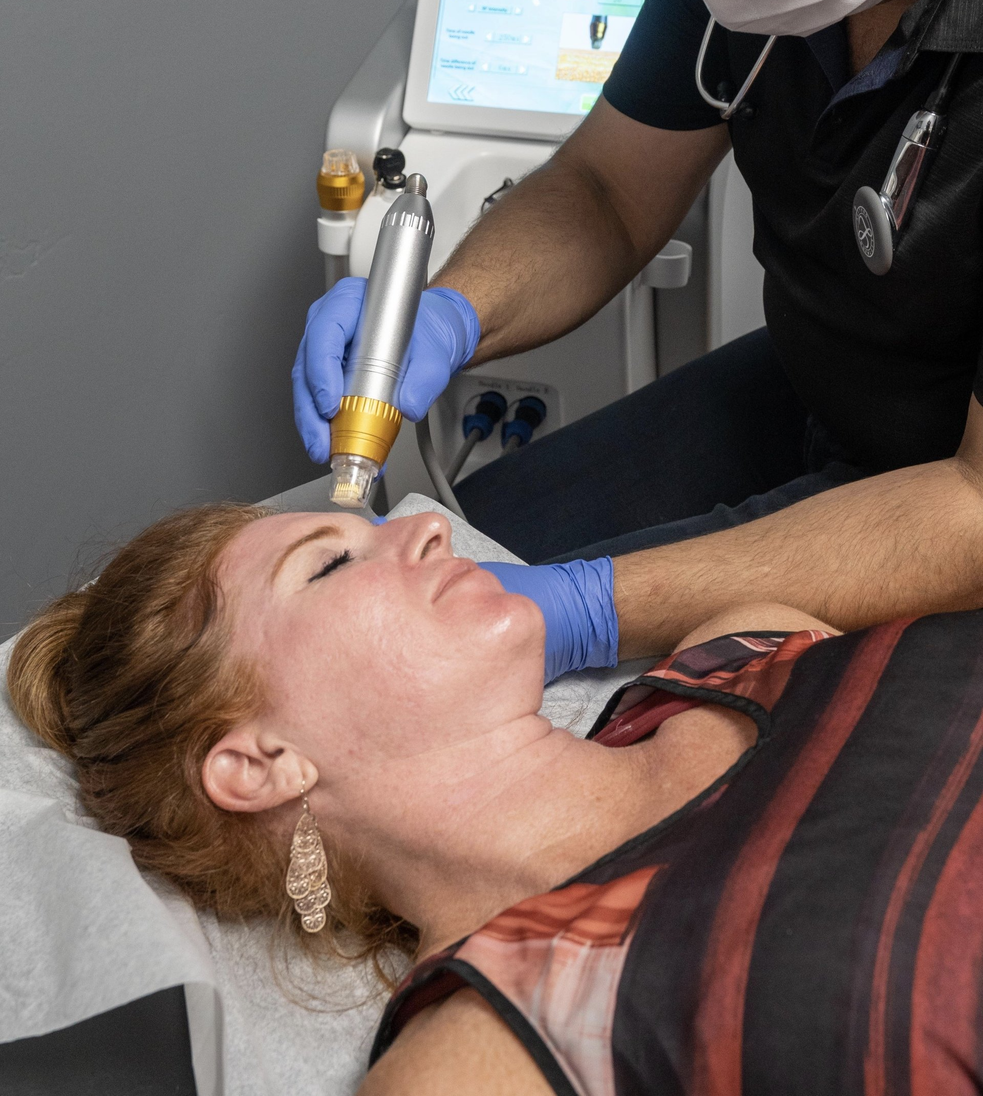 Microneedling San Marcos