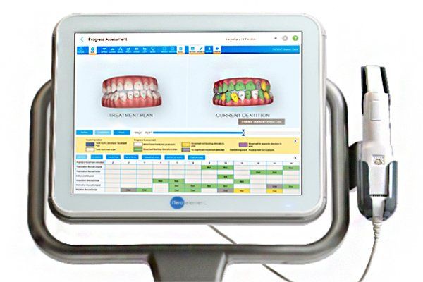 Flujo digital Invisalign