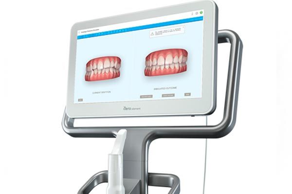 Simulador de resultados Invisalign
