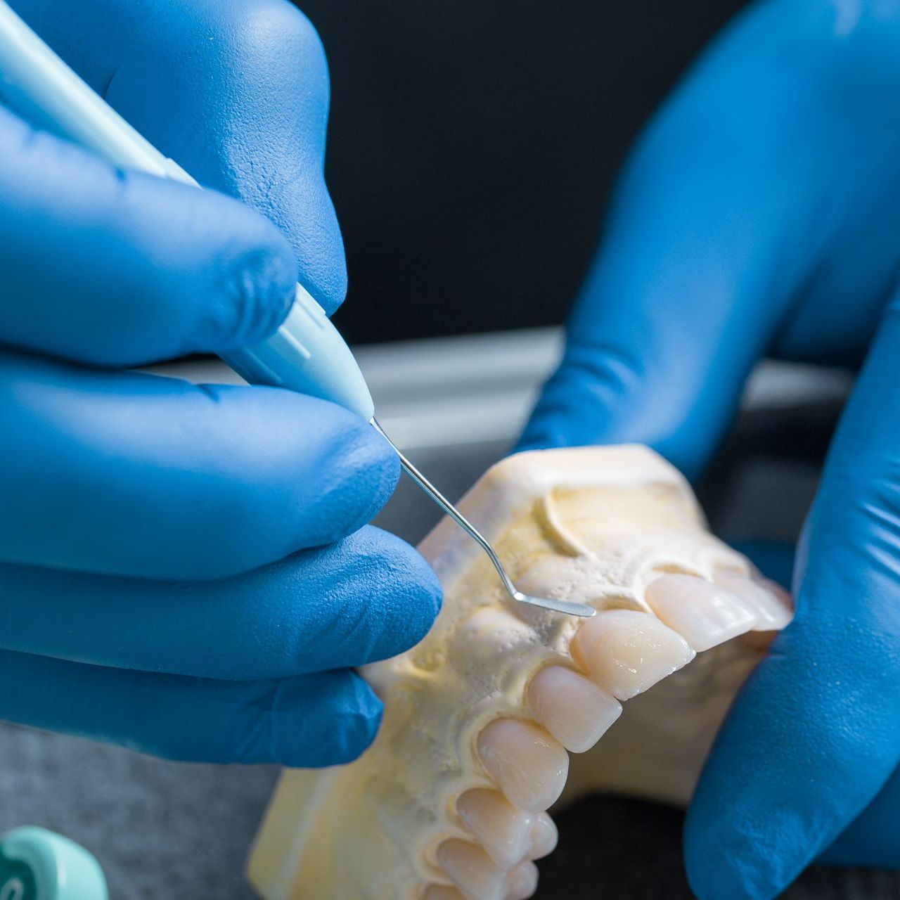 Denture Model — Port Noarlunga, SA — Natural Denture Clinic