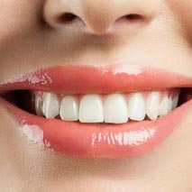 Beautiful white teeth — Dental Services in Durham, NC