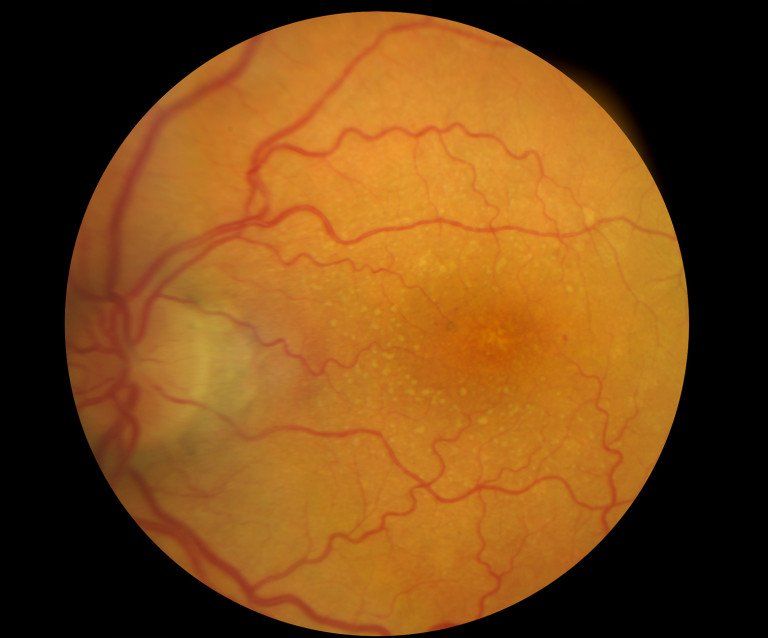 Surgeons Performing Eye Surgery