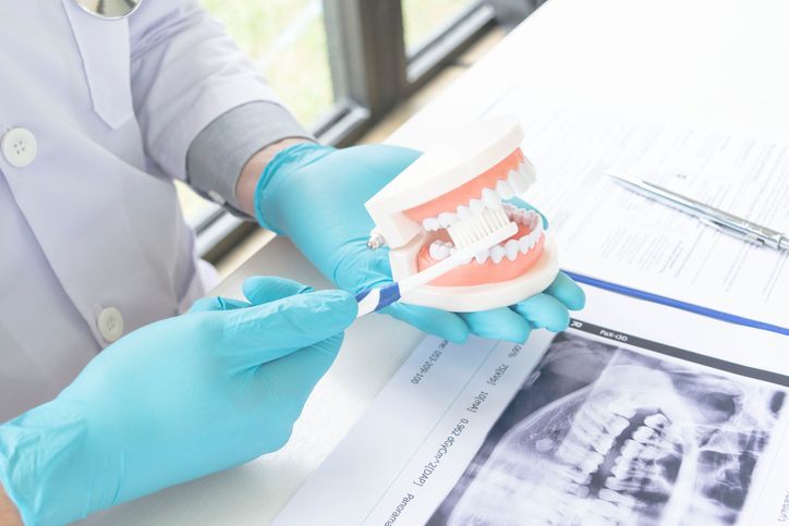 Sbiancamento dentale