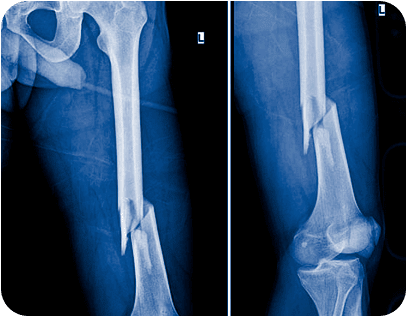 RADIOGRAFIAS A DOMICILIO DR OCTAVIANO CABRERA