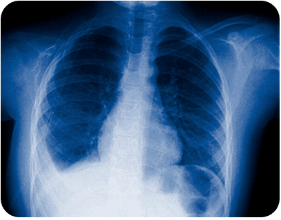 RADIOGRAFIAS A DOMICILIO DR OCTAVIANO CABRERA 