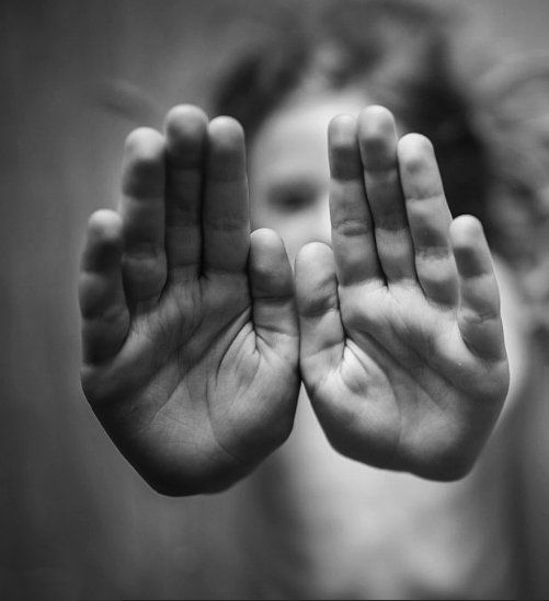 Plastic Surgery - Children Johannesburg