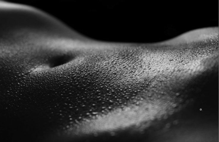 Liposuction Johannesburg | Dr. Anton Brewis