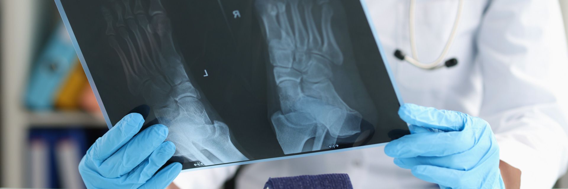 A doctor is holding an x-ray of a foot.