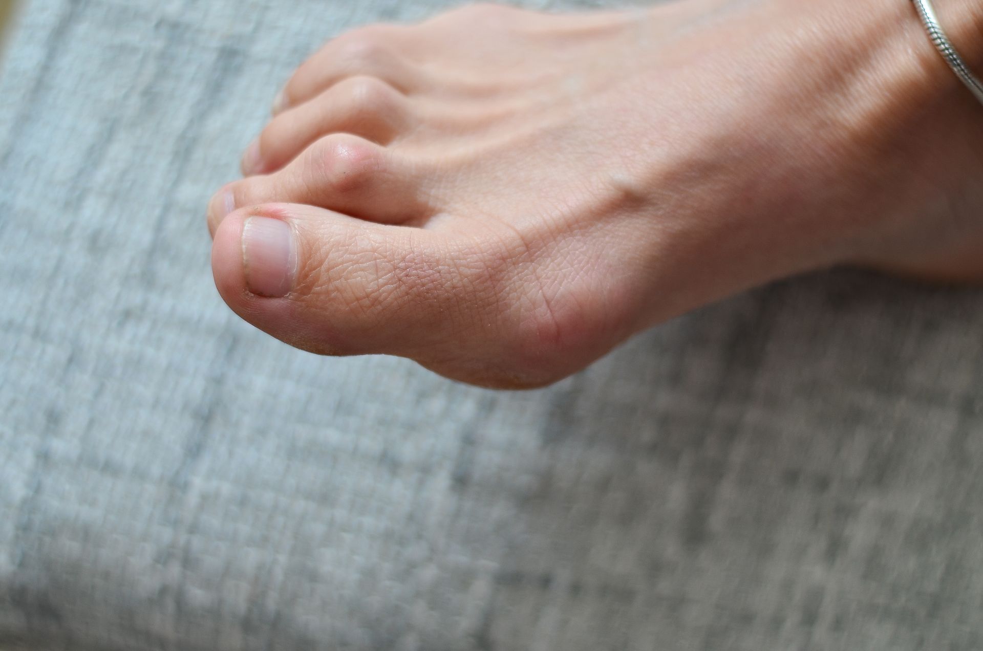 A close up of a person 's foot with a ring on it.