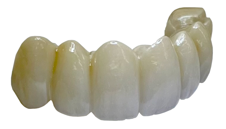 Custom crown & bridge dental lab service in Rexburg, ID