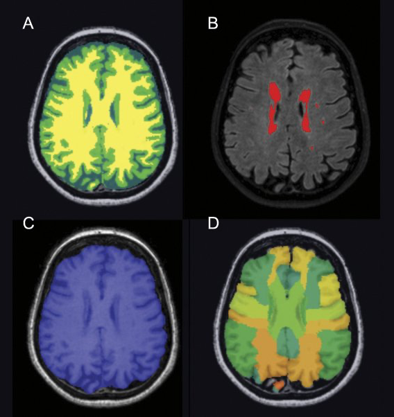 Hier kan een uxitgebreider bijschrift worden geplaatst.