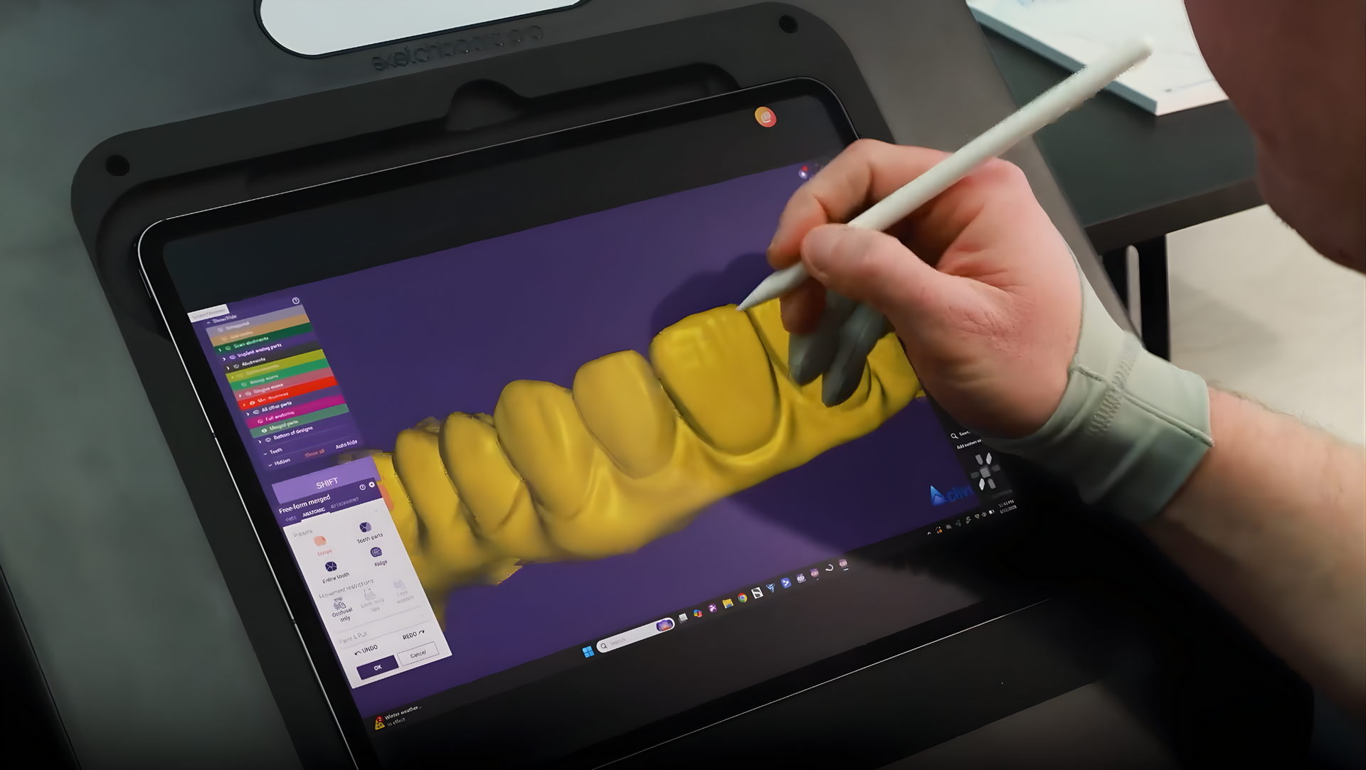 Man in dentist chair having teeth shade matched for a filling procedure at McMahon Dental.