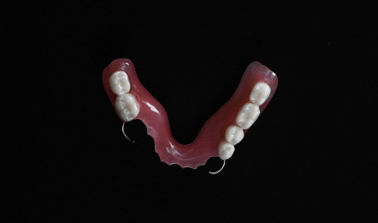 Woman smiling as dentist compares veneer shades to her teeth.