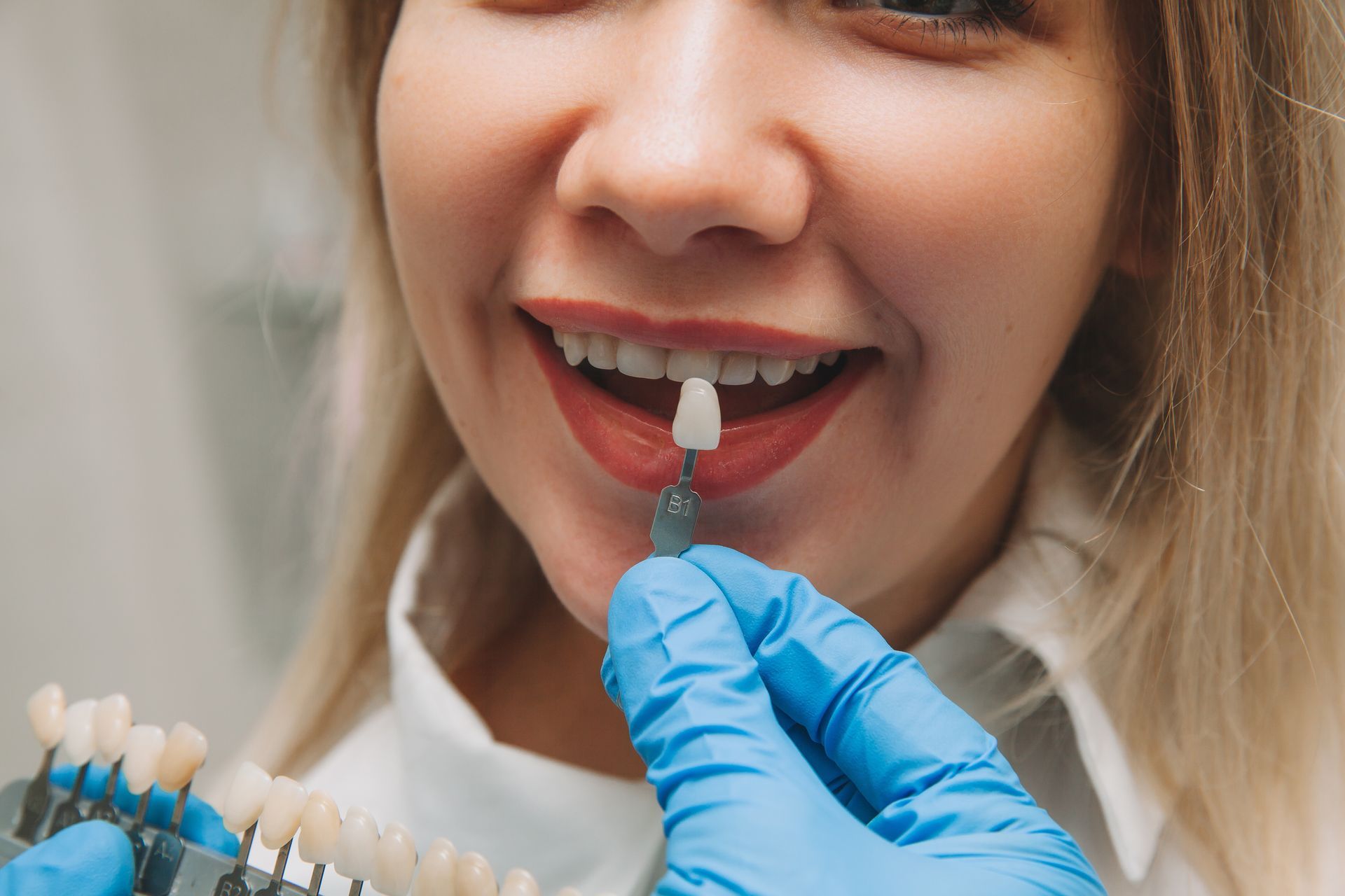 Hands holding a dental model showing upper and lower teeth.