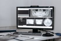 Medical scans displayed on a desktop monitor above a desk with keyboard and mouse
