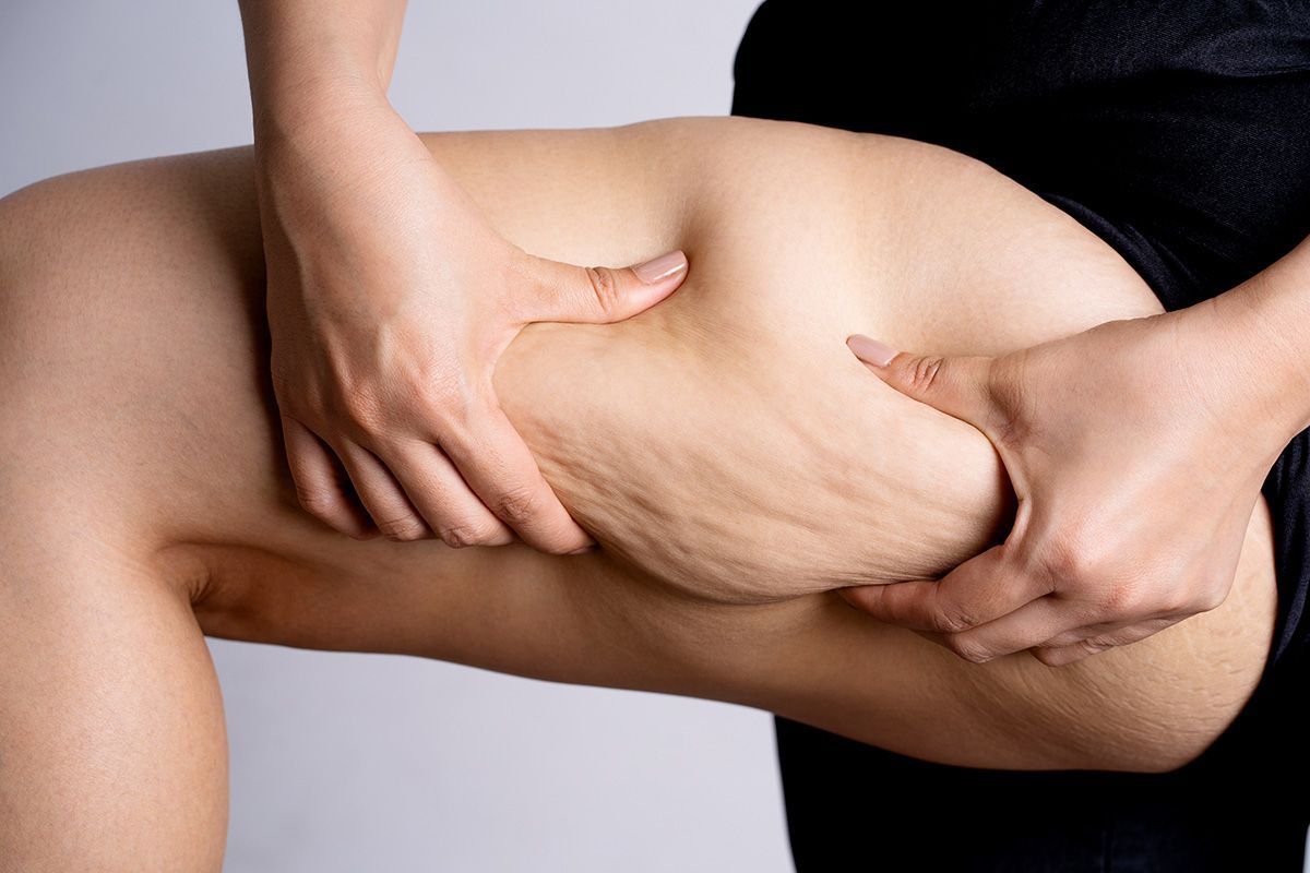 a woman is holding her thigh with her hands