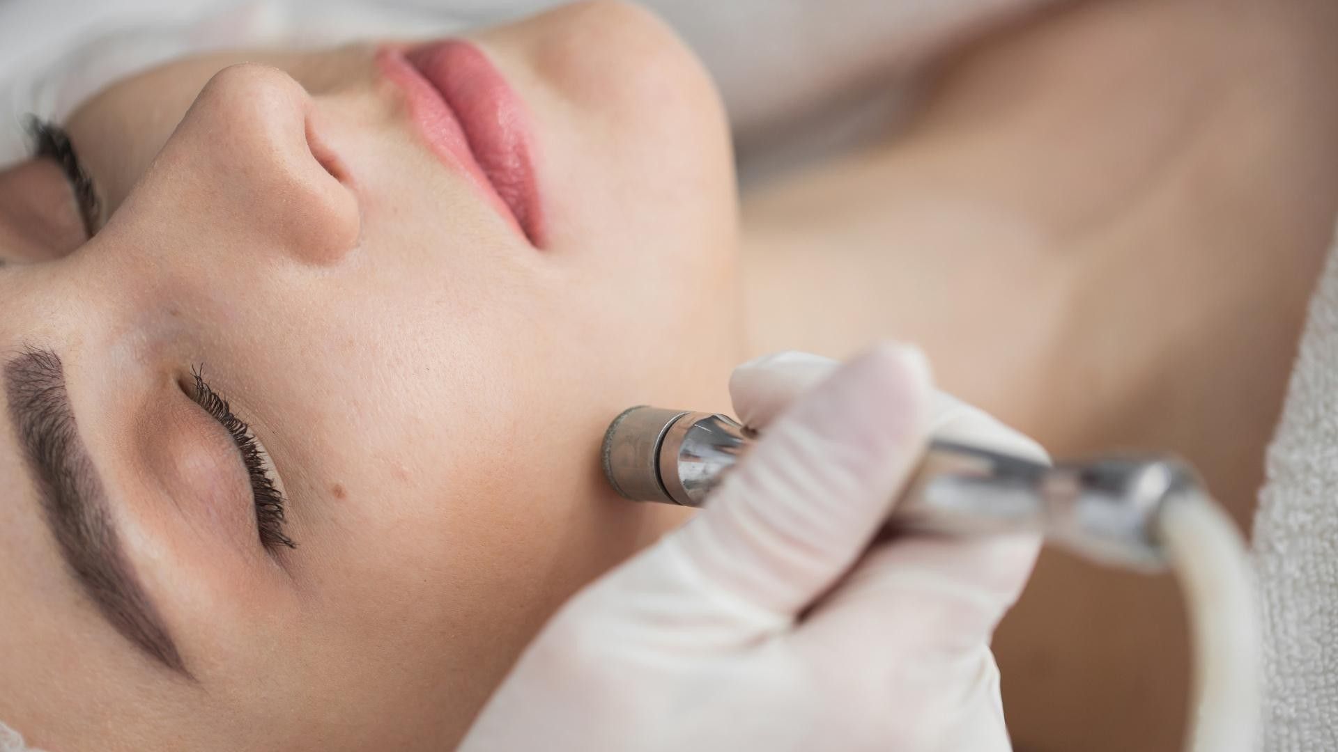 Diamond Glow in Carmel, IN - Erase Fine Lines, Reveal Youth