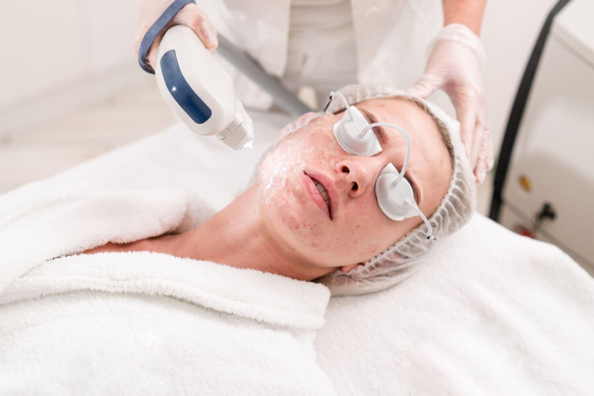 Our Laser Acne Scar Treatments at Michele Finley Cosmetic Medicine