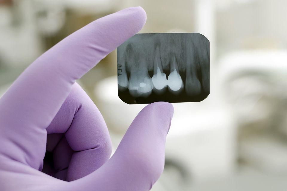 protesi fisse e mobili