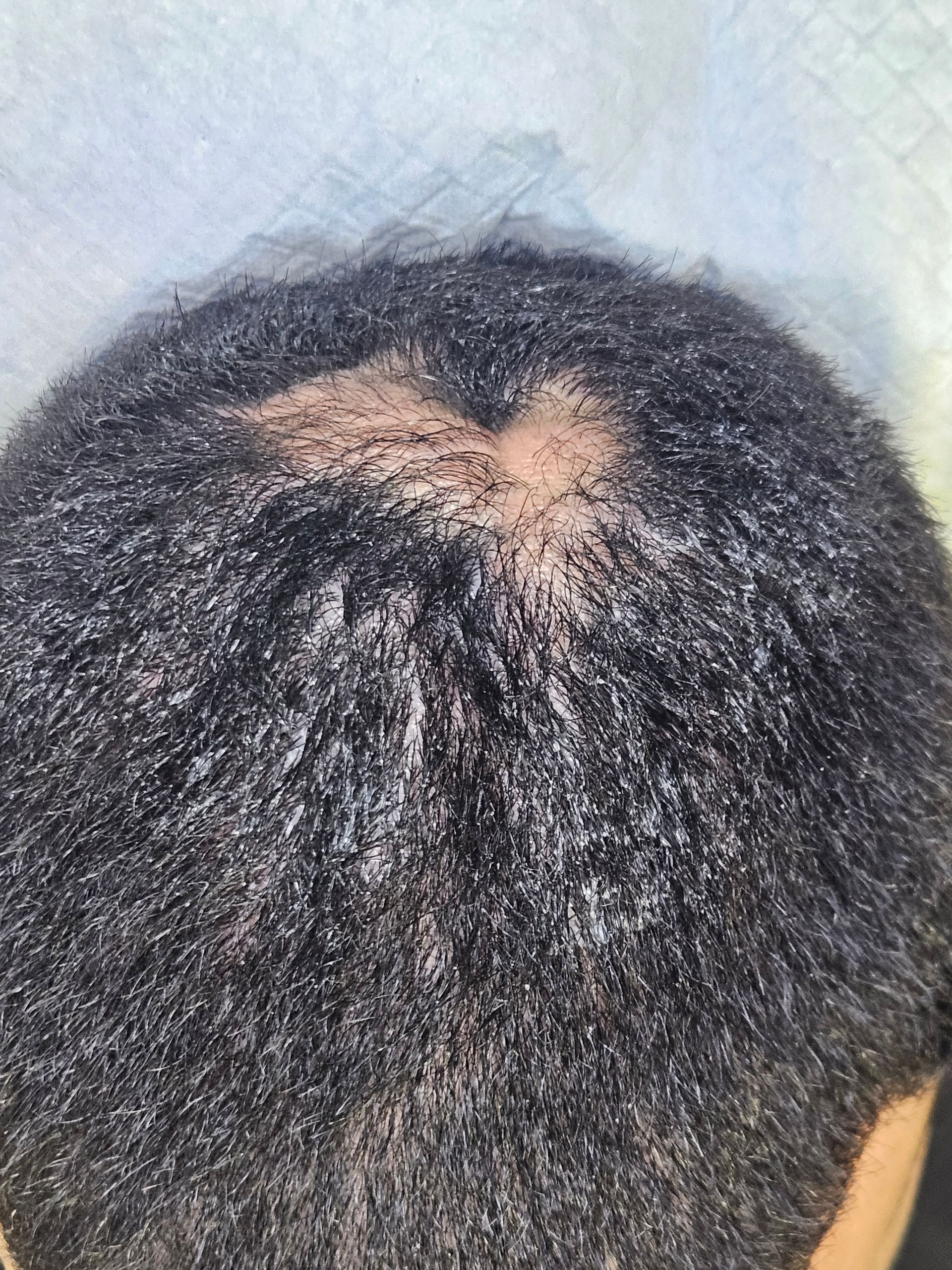 Man with short, dark hair and thinning spot on the crown of his head, sitting indoors.