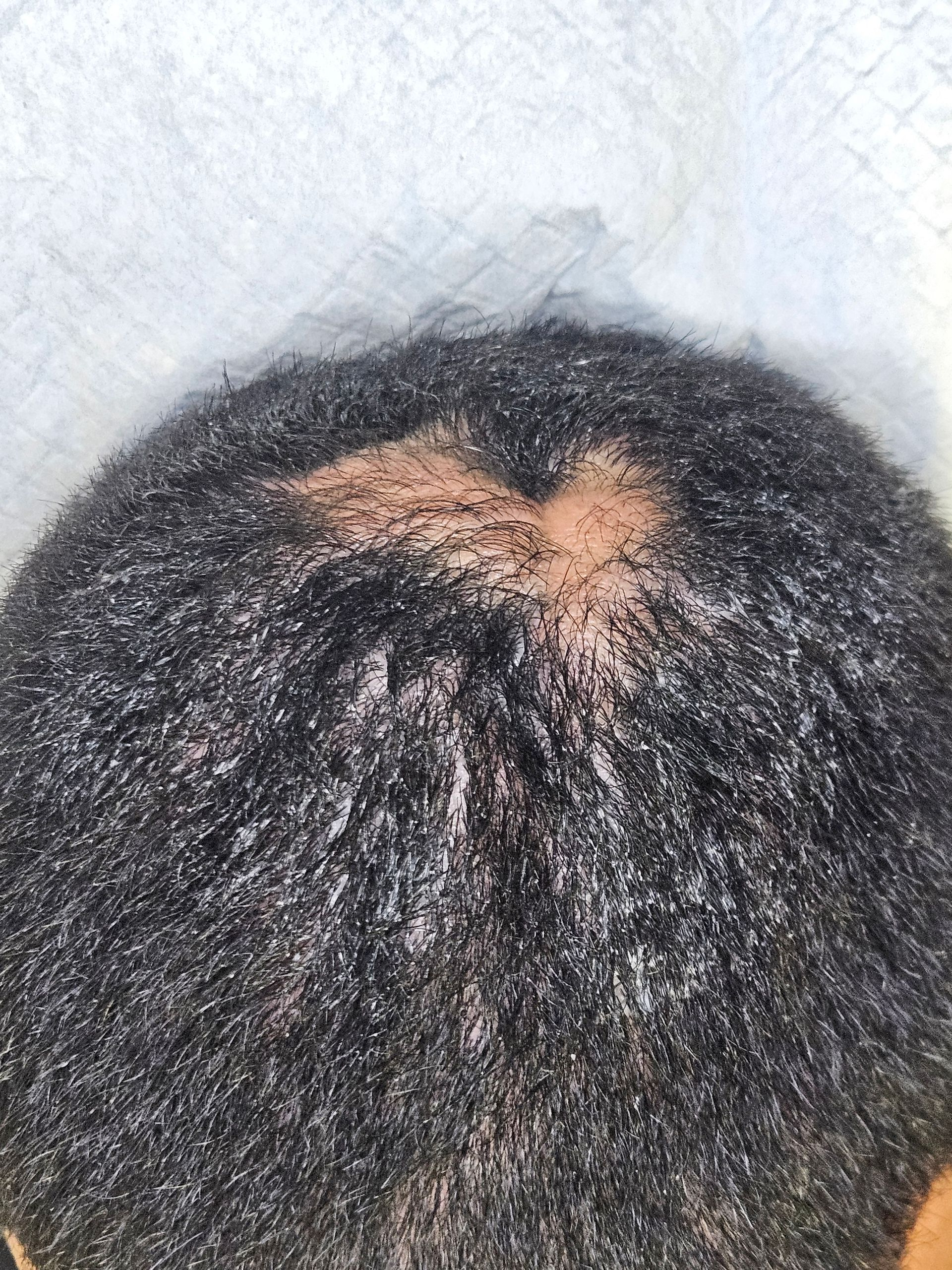 Man with short, dark hair and thinning spot on the crown of his head, sitting indoors.