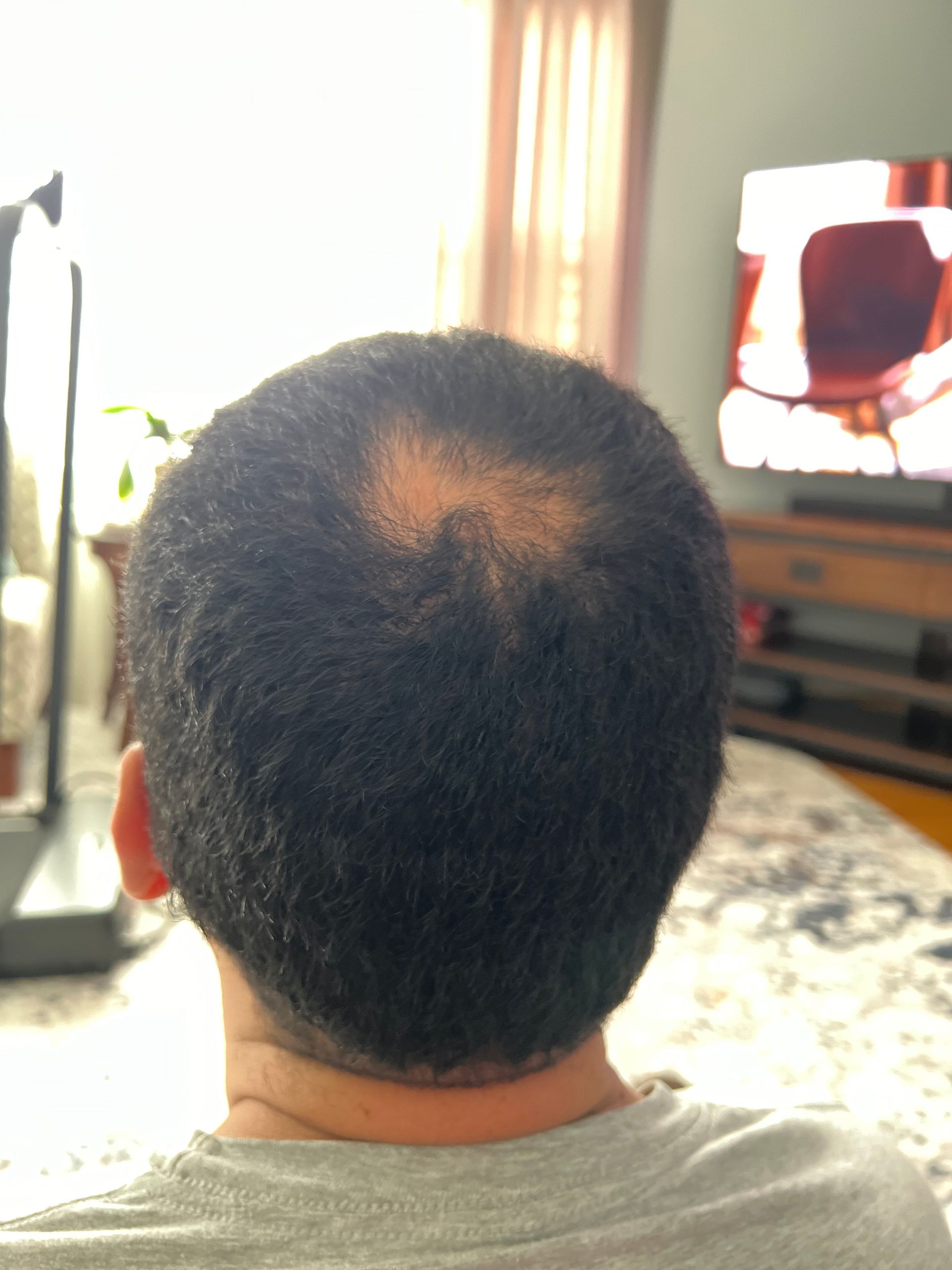 Man with short, dark hair and thinning spot on the crown of his head, sitting indoors.