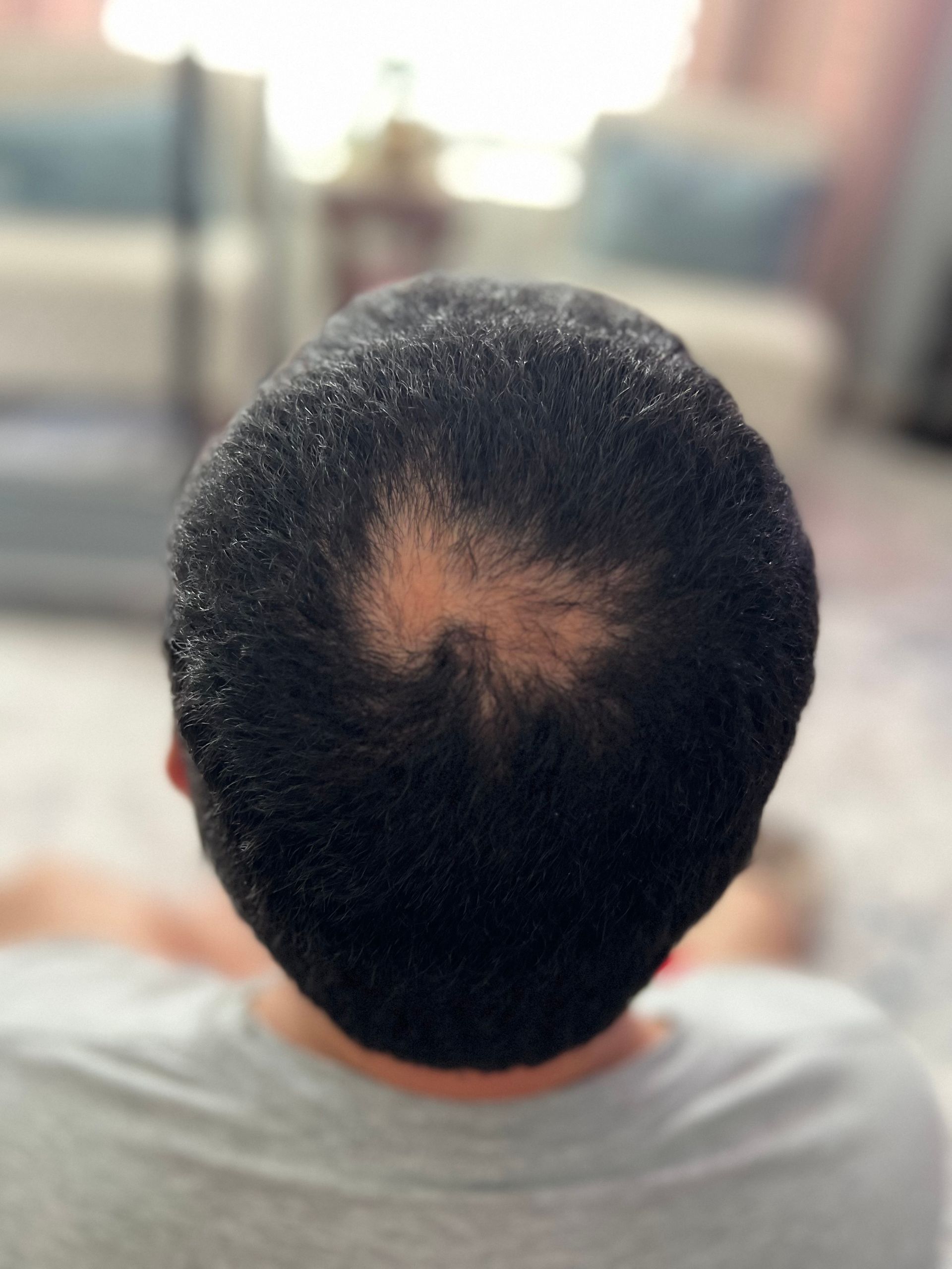 Man with short, dark hair and thinning spot on the crown of his head, sitting indoors.